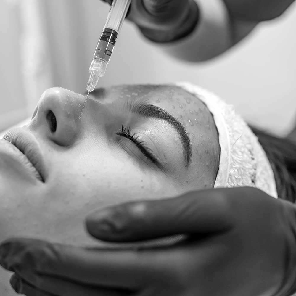 Mésothérapie du visage chez Medic Estet au Luxembourg
